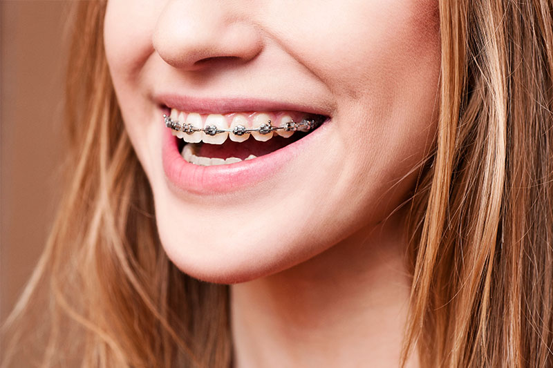 Orthodontics in Westmont